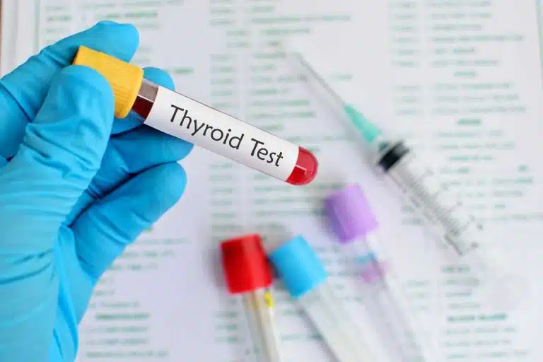 methode thyroide turbo boostez votre metabolisme et perdez du poids naturellement 1