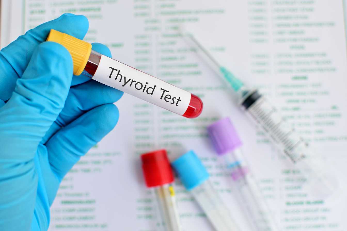 methode thyroide turbo boostez votre metabolisme et perdez du poids naturellement 1