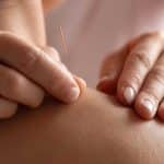 point acupuncture pied guide complet des points bienfaits et techniques de stimulation 1