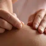 point acupuncture pied guide complet des points bienfaits et techniques de stimulation 1